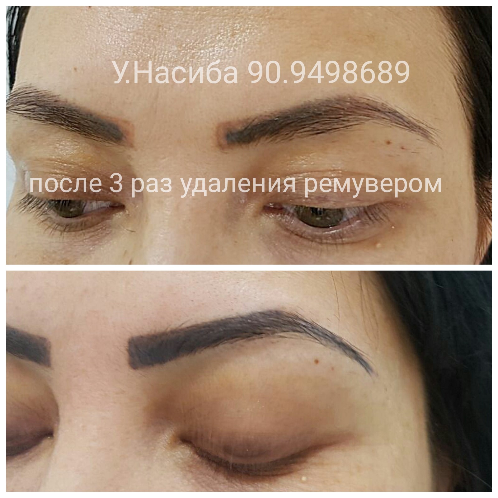 Item 9