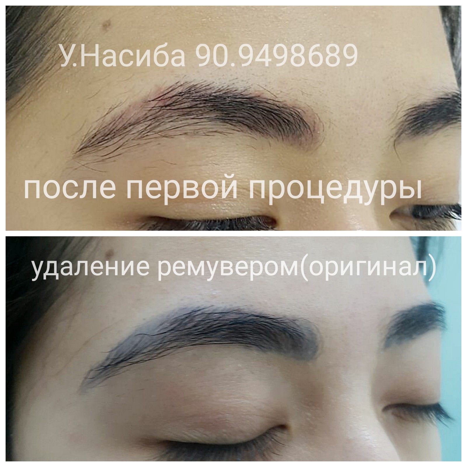 Item 8