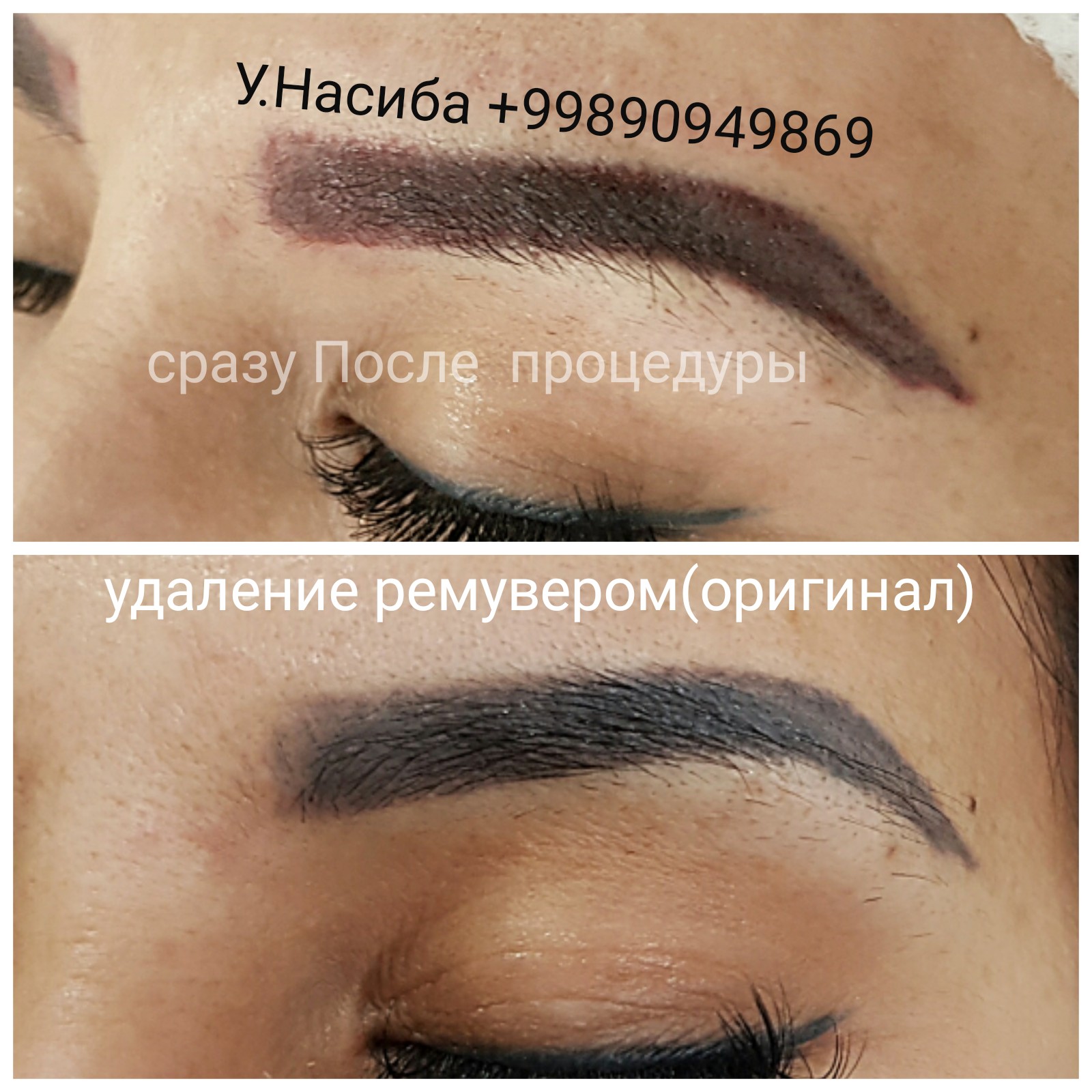 Item 12